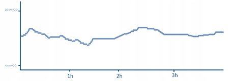 Dreamstation 2 AutoCPAP